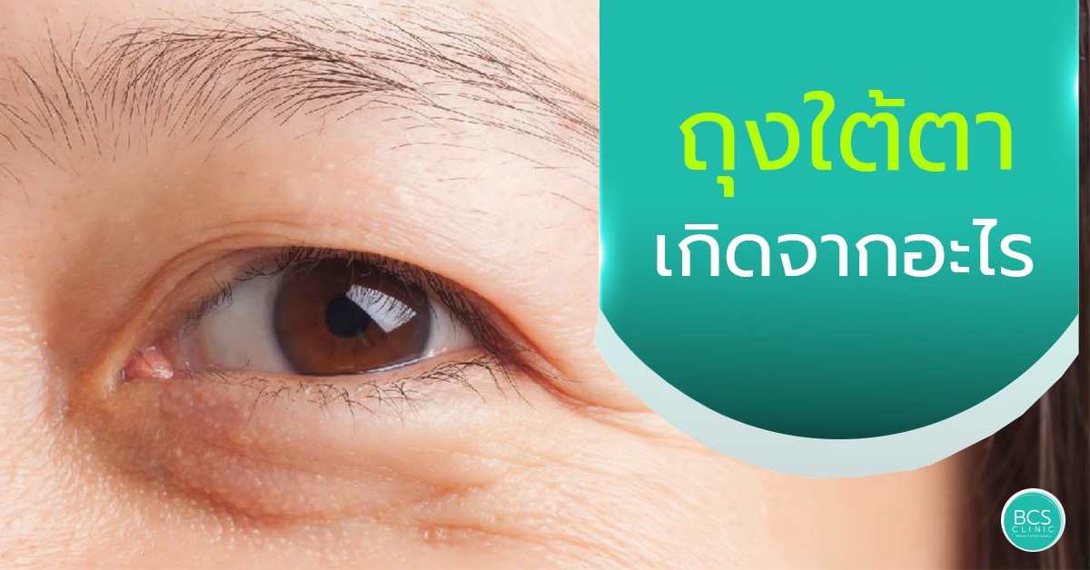 การเกิดถุงใต้ตามักเกิดจากสาเหตุอะไร