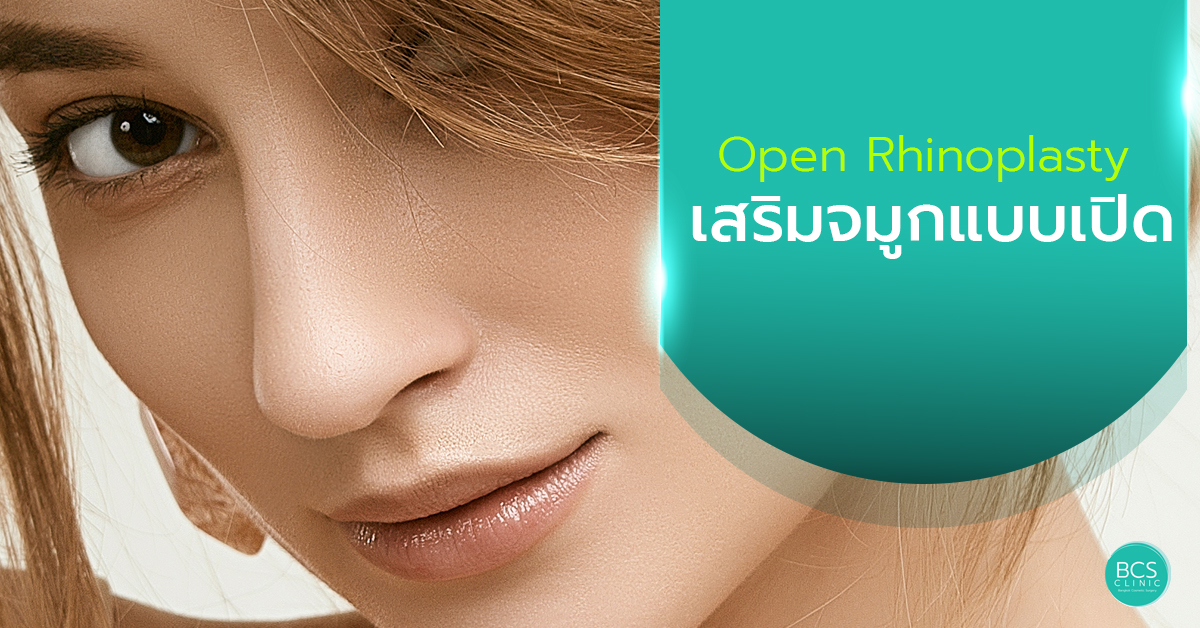 เสริมจมูกแบบเปิด Open Technique