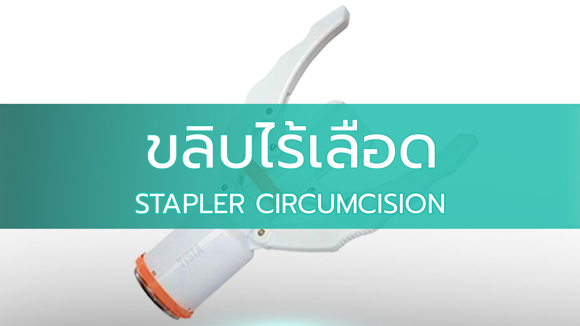ขลิบไร้เลือด-1_0 การขลิบไร้เลือด (Staple Circumcision)
