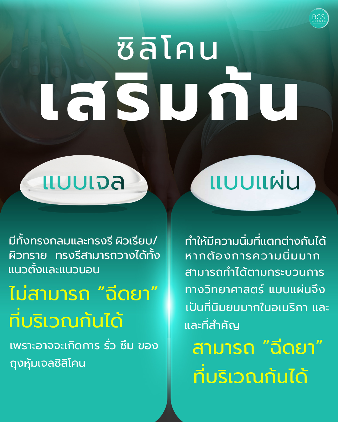 ซิลิโคนเสริมก้น แบบเจล VS แบบแผ่น | เลือกแบบไหนดี?