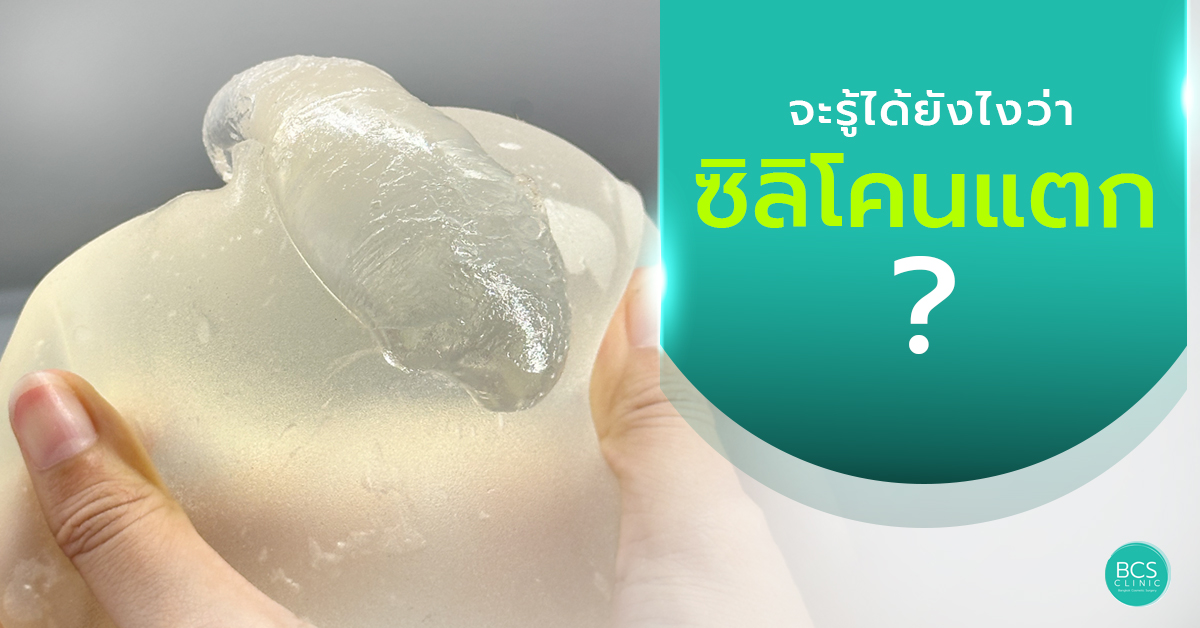 จะรู้ได้ยังไงว่า “ซิลิโคนแตก”? อาการซิลิโคนแตกที่ควรรู้